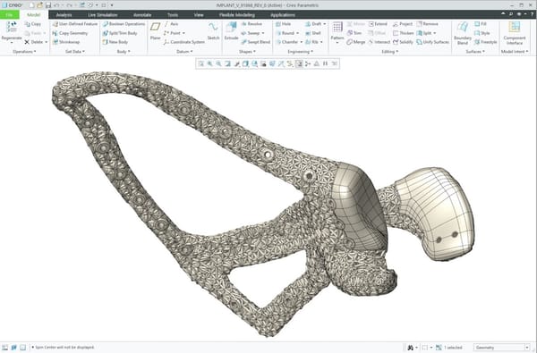 Innovation chirurgicale : l’implant sur mesure